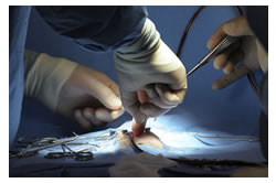 Surgeons working