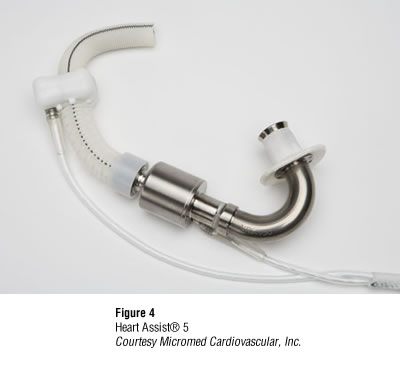 Mcs Device CCAS News - The Congenital Cardiac Anesthesia Society Newsletter